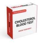 Cholesterol Blood Test: Essential Insights for Mansfield Residents